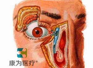 “康為醫(yī)療”高級(jí)鼻淚管通液訓(xùn)練模型