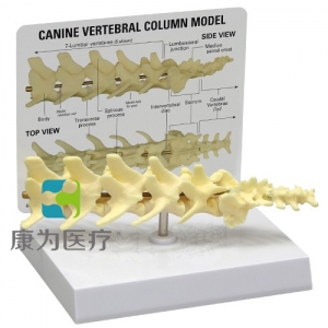 “康為醫(yī)療”醫(yī)患關(guān)系溝通模型-正常椎柱模型 （醫(yī)學指導模型）